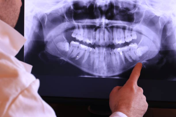 Best Emergency Tooth Extraction in Sage, CA